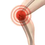 Artrosi del ginocchio: cos’è e rimedi naturali