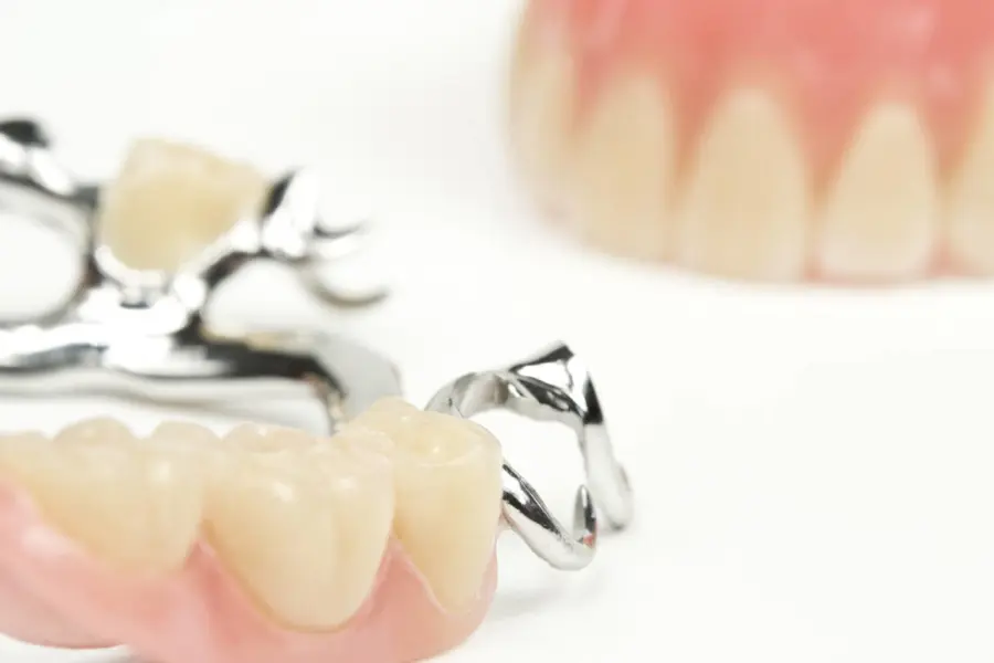 SFP: Impianti dentali Massa