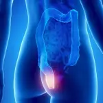 Proctologia, il dolore provocato dalle fistole