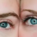 Lo Strabismo: cosa è, Come si cura