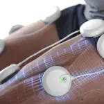 L’elettrostimolazione è veramente efficace?