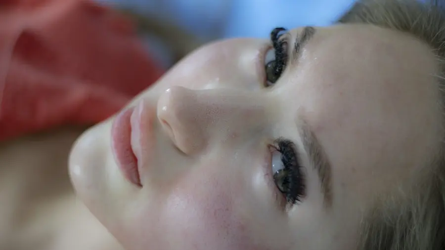 Alcuni rimedi naturali per l’acne