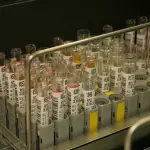 Le possibili cause delle urine scure