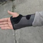 Come prevenire la sindrome del tunnel carpale