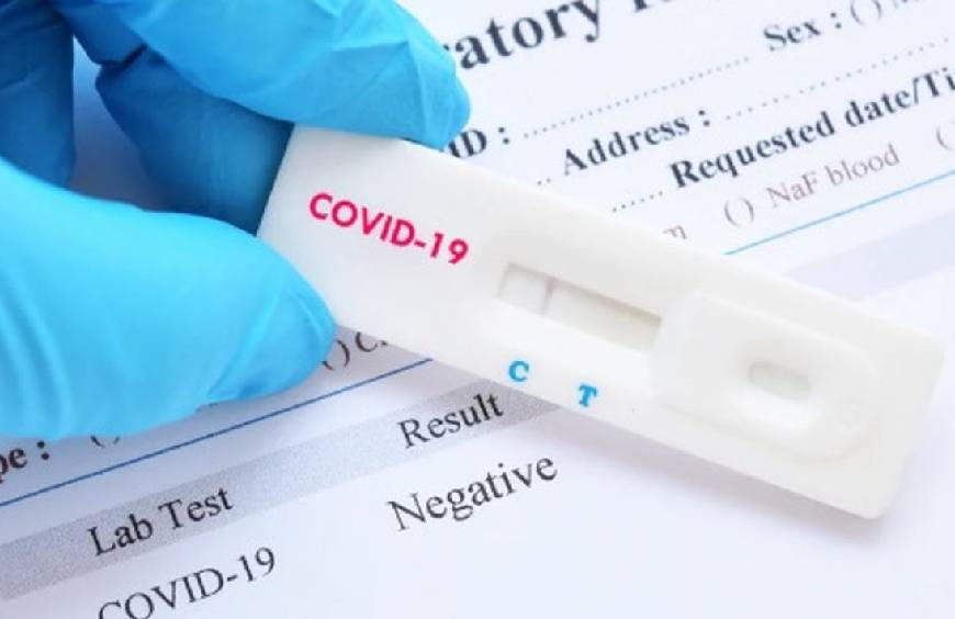 Il nuovo test Rapido per Antigene COVID 19