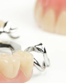 Impianti denti Massa